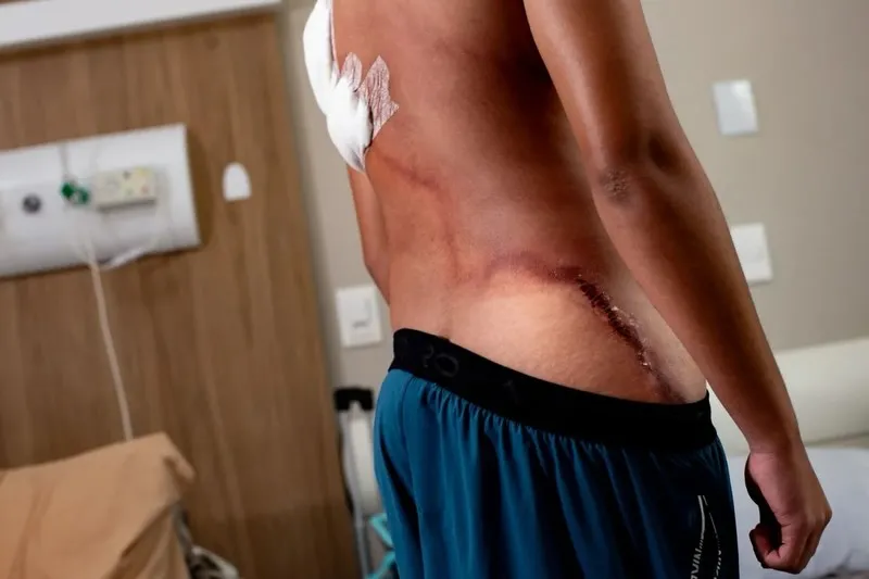 Adolescente atingido por raio durante ato político de Nikolas recebe alta hospitalar; veja fotos